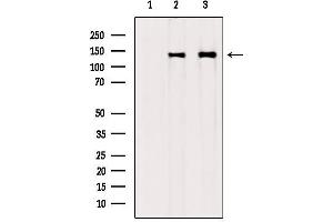 Western blot analysis of extracts from various samples, using Collagen Type VI antibody.