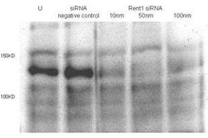 Total lysates (50 μg per lane) from Hela cells untransfected (U) or transfected with negative siRNA control or Rent1 siRNAs of 10nm, 50nm to 100nm. (RENT1/UPF1 antibody  (AA 583-612))