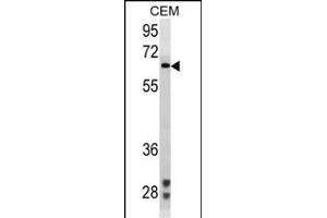Z Antibody ABIN1539941 western blot analysis in CEM cell line lysates (35 μg/lane). (ZAP70 antibody)