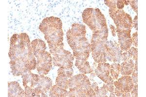 Formalin-fixed, paraffin-embedded human Skin tissue stained with EpCAM Mouse Recombinant Monoclonal Antibody (rEGP40/1372).