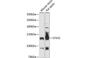 Western blot analysis of extracts of various cell lines, using STK31 antibody (ABIN6132843, ABIN6148608, ABIN6148609 and ABIN6216974) at 1:3000 dilution.
