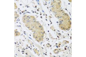 Immunohistochemistry of paraffin-embedded human stomach using IL4 antibody at dilution of 1:100 (40x lens).