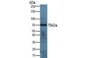 Rabbit Detection antibody from the kit in WB with Positive Control:  Sample Human jurkat cells. (ADAM17 ELISA Kit)