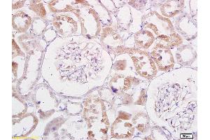 Formalin-fixed and paraffin embedded rat kidney labeled with Anti-TRADD Polyclonal Antibody, Unconjugated (ABIN673314) at 1:200 followed by conjugation to the secondary antibody and DAB staining. (TRADD antibody  (AA 111-230))