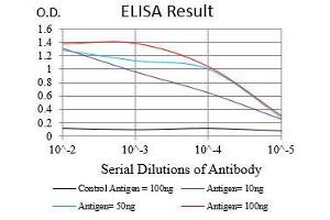 Black line: Control Antigen (100 ng), Purple line: Antigen(10 ng), Blue line: Antigen (50 ng), Red line: Antigen (100 ng), (ZEB1 antibody  (AA 967-1108))