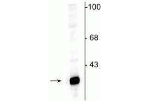 Western Blotting (WB) image for anti-Protein Phosphatase 1, Regulatory (Inhibitor) Subunit 1B (PPP1R1B) (N-Term) antibody (ABIN361423)