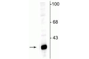 Western blot of rat hippocampal lysate showing specific immunolabeling of the ~32 kDa DARPP protein. (DARPP32 antibody  (N-Term))