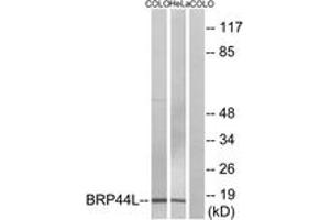 Western blot analysis of extracts from COLO/HeLa cells, using BRP44L Antibody. (BRP44L antibody  (AA 11-60))