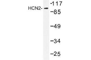 Image no. 1 for anti-Hyperpolarization Activated Cyclic Nucleotide-Gated Potassium Channel 2 (HCN2) antibody (ABIN317931) (HCN2 antibody)
