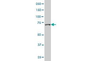 FBXL18 monoclonal antibody (M01), clone 3H5 Western Blot analysis of FBXL18 expression in A-431 .