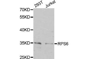 Western Blotting (WB) image for anti-Ribosomal Protein S6 (RPS6) antibody (ABIN1877085) (RPS6 antibody)