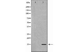 Western blot analysis of extracts of HeLa  using H3K9me1 antibody. (Histone 3 antibody  (H3K9me))