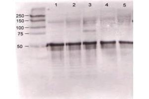 Rabbit anti-Ang-1 was used at a 1:500 dilution to detect mouse Ang-1 by western blot against supernatants of mouse angiopoietin-expressing endothelial cells.