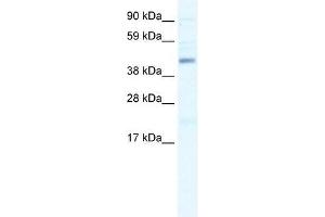 SMARCB1 antibody used at 1. (SMARCB1 antibody  (N-Term))