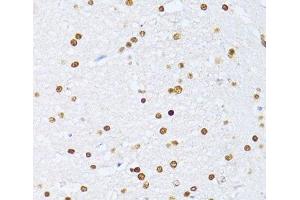 Immunohistochemistry of paraffin-embedded Rat brain using ZEB2 Polyclonal Antibody at dilution of 1:100 (40x lens). (ZEB2 antibody)