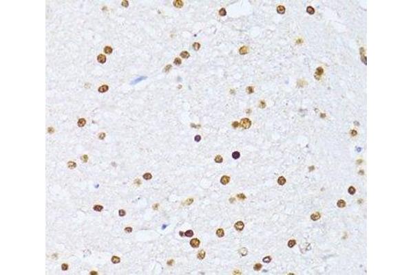 ZEB2 antibody