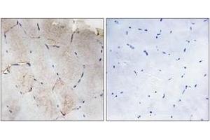 Immunohistochemistry analysis of paraffin-embedded human skeletal muscle tissue, using Collagen XII alpha1 Antibody.