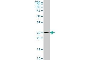 IDI1 monoclonal antibody (M01), clone 6G10 Western Blot analysis of IDI1 expression in HeLa . (IDI1 antibody  (AA 175-283))