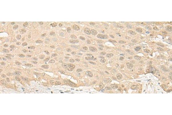 IMPA1 antibody