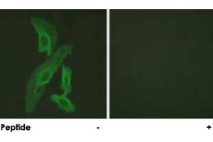 Immunofluorescence analysis of HeLa cells, using BCL2L1 polyclonal antibody . (BCL2L1 antibody)