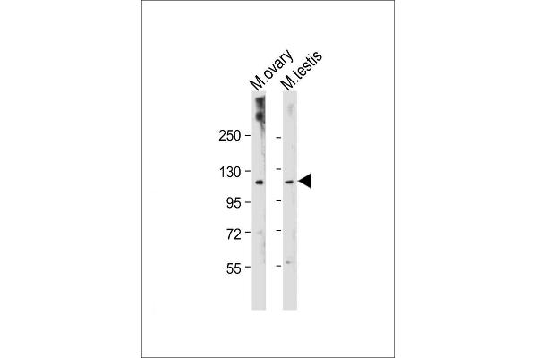LATS2 antibody  (C-Term)