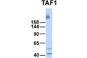 Host:  Rabbit  Target Name:  TAF1  Sample Type:  Human Fetal Liver  Antibody Dilution:  1. (TAF1 antibody  (Middle Region))