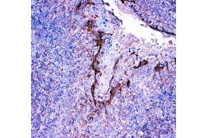 Immunohistochemistry (Paraffin-embedded Sections) (IHC (p)) image for anti-Profilin 2 (PFN2) (AA 125-140), (C-Term) antibody (ABIN3042861) (PFN2 antibody  (C-Term))