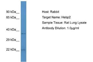 Host: Rabbit Target Name: HEBP2 Sample Tissue: Rat Lung Antibody Dilution: 1ug/ml (HEBP2 antibody  (N-Term))