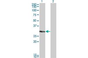 Western Blot analysis of KCNIP2 expression in transfected 293T cell line by KCNIP2 monoclonal antibody (M01), clone 3E7. (KCNIP2 antibody  (AA 1-100))