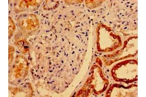 Immunohistochemistry of paraffin-embedded human kidney tissue using ABIN7175121 at dilution of 1:100 (Urocortin 2 antibody  (AA 72-112))