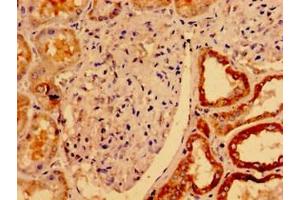 Immunohistochemistry of paraffin-embedded human kidney tissue using ABIN7175121 at dilution of 1:100 (Urocortin 2 antibody  (AA 72-112))