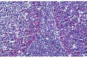 Human Tonsil: Formalin-Fixed, Paraffin-Embedded (FFPE) (FANCA antibody  (AA 1121-1170))