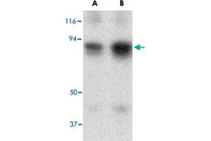 Western blot analysis of ATF6 in MDA-MB-361 cell lysate with ATF6 polyclonal antibody  at (A) 0. (ATF6 antibody  (N-Term))