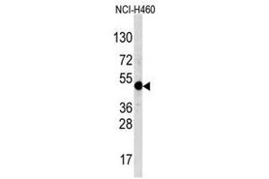 Image no. 1 for anti-Transcription Factor AP-2 alpha (Activating Enhancer Binding Protein 2 Alpha) (TFAP2A) (C-Term) antibody (ABIN357337) (TFAP2A antibody  (C-Term))