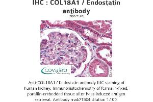 Image no. 1 for anti-Collagen, Type XVIII, alpha 1 (COL18A1) (full length) antibody (ABIN1724517) (COL18A1 antibody  (full length))