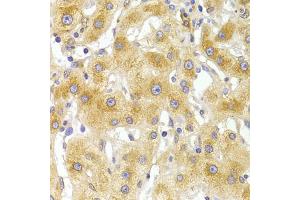 Immunohistochemistry of paraffin-embedded human liver injury using EIF4G1 Antibody (ABIN5975844) at dilution of 1/100 (40x lens). (EIF4G1 antibody)