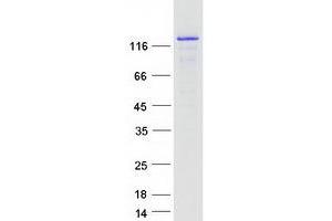 Validation with Western Blot (CCAR2 Protein (Transcript Variant 1) (Myc-DYKDDDDK Tag))