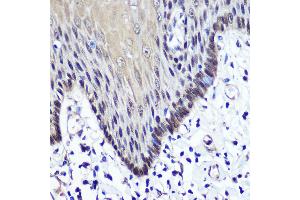 Immunohistochemistry of paraffin-embedded Human esophageal using TKT antibody (ABIN6128870, ABIN6149201, ABIN6149203 and ABIN6221921) at dilution of 1:100 (40x lens). (TKT antibody  (AA 1-280))
