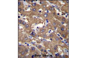 UGDH Antibody (C-term) (ABIN656544 and ABIN2845808) immunohistochemistry analysis in formalin fixed and paraffin embedded human liver tissue followed by peroxidase conjugation of the secondary antibody and DAB staining. (UGDH antibody  (C-Term))