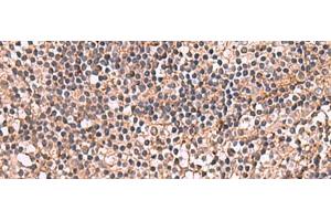 Immunohistochemistry of paraffin-embedded Human tonsil tissue using NOTCH4 Polyclonal Antibody at dilution of 1:30(x200) (NOTCH4 antibody)