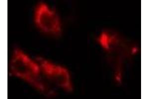 ABIN6275757 staining HuvEC cells by IF/ICC. (DGKB antibody  (C-Term))