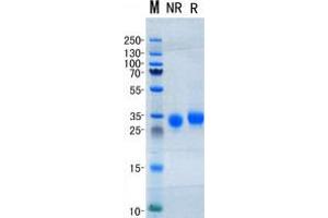 Validation with Western Blot (TIMP1 Protein (His tag))
