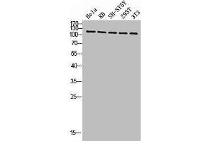 Western blot analysis of HELA KB SH-SY5Y 293T 3T3 lysis using Phospho-Eg5 (T926) antibody. (KIF11 antibody  (pThr926))