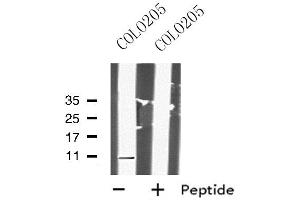 Western blot analysis of DAP using COLO205 whole cell lysates (DAP antibody  (N-Term))