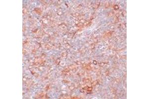 Immunohistochemistry of TMEM38B in mouse thymus tissue with this product at 5 μg/ml.