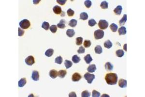 Immunocytochemistry of Acinus in K562 cells with AP30011PU-N Acinus antibody at 0. (ACIN1 antibody  (C-Term))