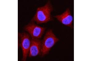IF analysis of OLAH using anti-OLAH antibody (ABIN7599930). (OLAH antibody  (AA 13-265))