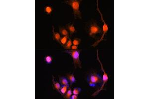 Immunofluorescence analysis of U-251 MG cells using PGP9. (UCHL1 antibody  (AA 59-223))