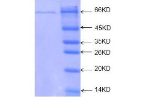 12% SDS-PAGE of recombinant TPM2 protein. (TPM2 Protein)