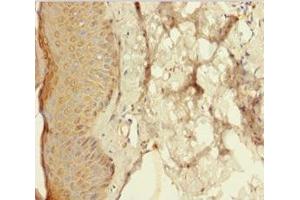 Immunohistochemistry of paraffin-embedded human skin tissue using ABIN7167717 at dilution of 1:100 (Resistin antibody  (AA 19-108))